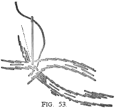 Illustration 4 on how to embroider the chrysanthemum
